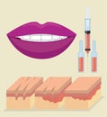 Layers of skin with botox injection