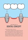 Layout Bridges teeth implant illustration vector on blue background. Dental concept.