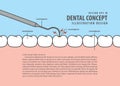 Layout decay tooth check up Caries cartoon style for info or b