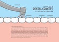 Layout decay tooth treatment Caries cartoon style for info or