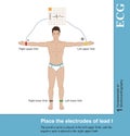 Place the electrodes of lead I Royalty Free Stock Photo