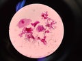 LEADURIFFORM CELLS (HYFAS) IN BIOLOGICAL SAMPLE. Gram color.