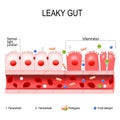 Leaky gut Royalty Free Stock Photo