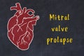 Concept of learning cardiovascular system. Chalk drawing of human heart and inscription Mitral valve prolapse