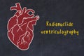 Learning cardio system concept. Chalk drawing of human heart and inscription Radionuclide ventriculography Royalty Free Stock Photo