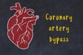 Learning cardio system concept. Chalk drawing of human heart and inscription Coronary artery bypass
