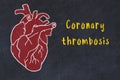 Learning cardio system concept. Chalk drawing of human heart and inscription Coronary thrombosis