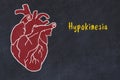 Learning cardio system concept. Chalk drawing of human heart and inscription Hypokinesia