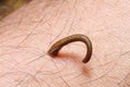Leech on human skin Royalty Free Stock Photo