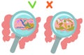 On the left is intestine with normal microflora, on the right is a poor composition of microflora with pathogenic