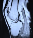 Left knee mri Royalty Free Stock Photo