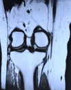 Left knee mri Royalty Free Stock Photo