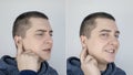 Before and after. On the left, the man indicates ear pain, and on the right, indicates that the ear no longer hurts. Pain