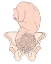 Left Occiput Anterior LOA Baby Fetal Position ROA Right