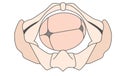 Left Occiput Transverse | LOT Baby Fetal Position Pelvis ROT Right