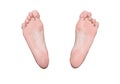 Left and right foot soles, female feet, medical concept