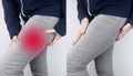 Before and after. On left, a woman has acute pain in the hip after a muscle strain or tear. On right, doctors have healed and the Royalty Free Stock Photo