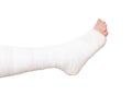 Leg bandaged in a tight dressing, plaster cast for fracture of the leg and ankle joint, isolate