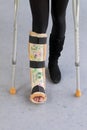 Leg cast and crutches