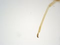 Cotton worm leg 100x Magnification