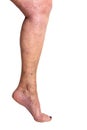 Leg of elderly Caucasian woman with spider veins and varicose veins on toes isolated on white background. Health, cosmetic, beauty Royalty Free Stock Photo