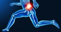 Leg joint pain