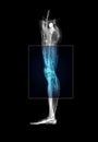 Leg MRI