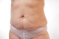 Legs and belly of a 40-year-old woman with stretch marks, cellulite and excess weight on a white isolated background Royalty Free Stock Photo