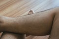 Legs hair of asian man close up