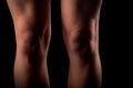 Legs knees woman black background