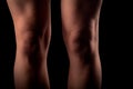 Legs knees woman black background Royalty Free Stock Photo