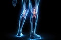 Legs of a man with knee pain in the form of an x-ray on a dark background. Tendon problems and joint inflammation Royalty Free Stock Photo