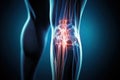 Legs of a man with knee pain in the form of an x-ray on a dark background. Tendon problems and joint inflammation Royalty Free Stock Photo