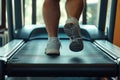 Legs of overweight person run on treadmill in gym