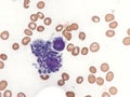 Leishmaniasis in bone marrow. Royalty Free Stock Photo