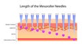 Length of the mesoroller needles, Vector illustration Royalty Free Stock Photo