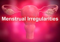 Letter menstrual irregularities. Medical concept of changing the menstrual cycle