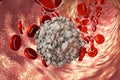 Leukaemia white blood cell Royalty Free Stock Photo