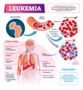Leukemia vector illustration. Labeled educational blood cancer infographic.