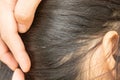 Lice in hair and comb