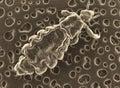 Lice louse. Electron microscope photo