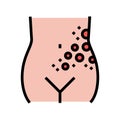 lichen shingles disease color icon vector illustration