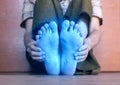 Light blue colored feet of Asian man. Concept of tingling and numbness or cold and clumsy foot Royalty Free Stock Photo