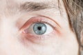 Light gray-blue eye looks up. Royalty Free Stock Photo