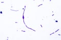 Light micrograph of bacteria Bacillus anthracis