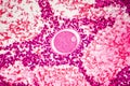 Light micrograph of human ovary