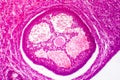 Light micrograph of human ovary Royalty Free Stock Photo