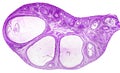 Light micrograph of ovary