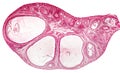 Light micrograph of ovary