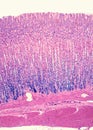 Gastric mucosa Royalty Free Stock Photo